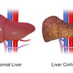 liver
