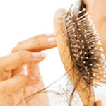 hairfall