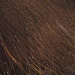 Home Remedies for Dandruff