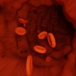 Low Blood Platelet Causes Symptoms and Treatment