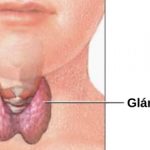 Thyroid Causes Symptoms and Treatment