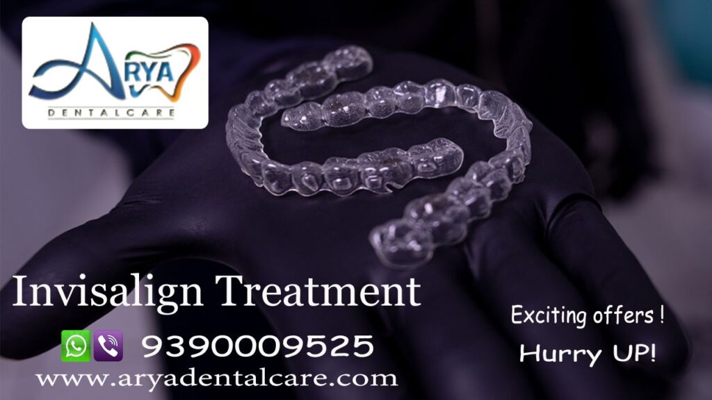 Root Canal Treatment 