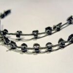 Dental Braces Types, Benefits and Durability