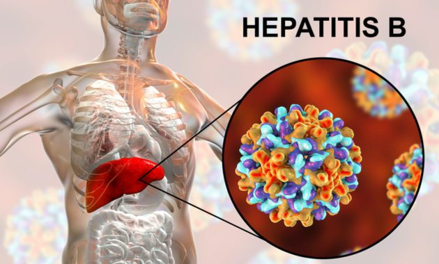 Hepatitis B: Causes, Symptoms, And Prevention