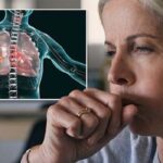 Symptoms And Causes Of Lung Cancer