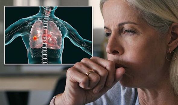 Symptoms And Causes Of Lung Cancer