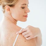 Skin Cancer In Women