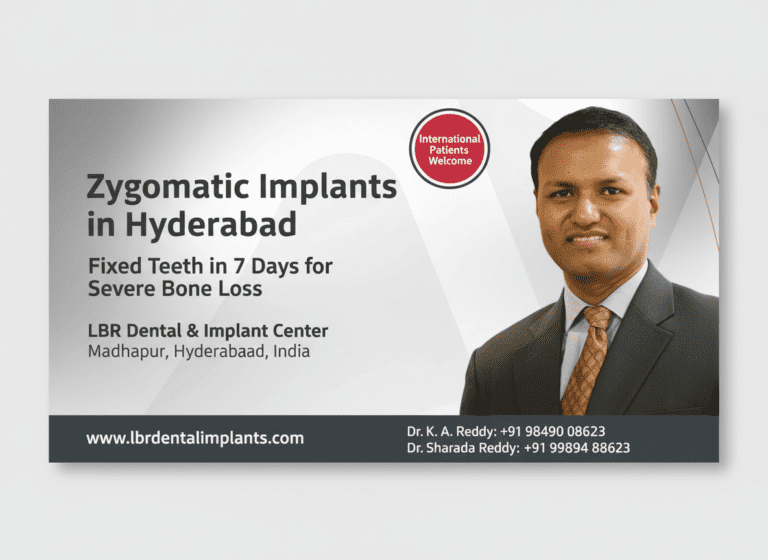 Zygomatic Implants in Hyderabad