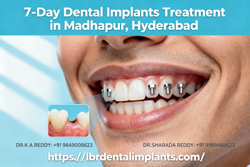 Dental Implants treatment in 7 Days in Madhapur Hyderabad